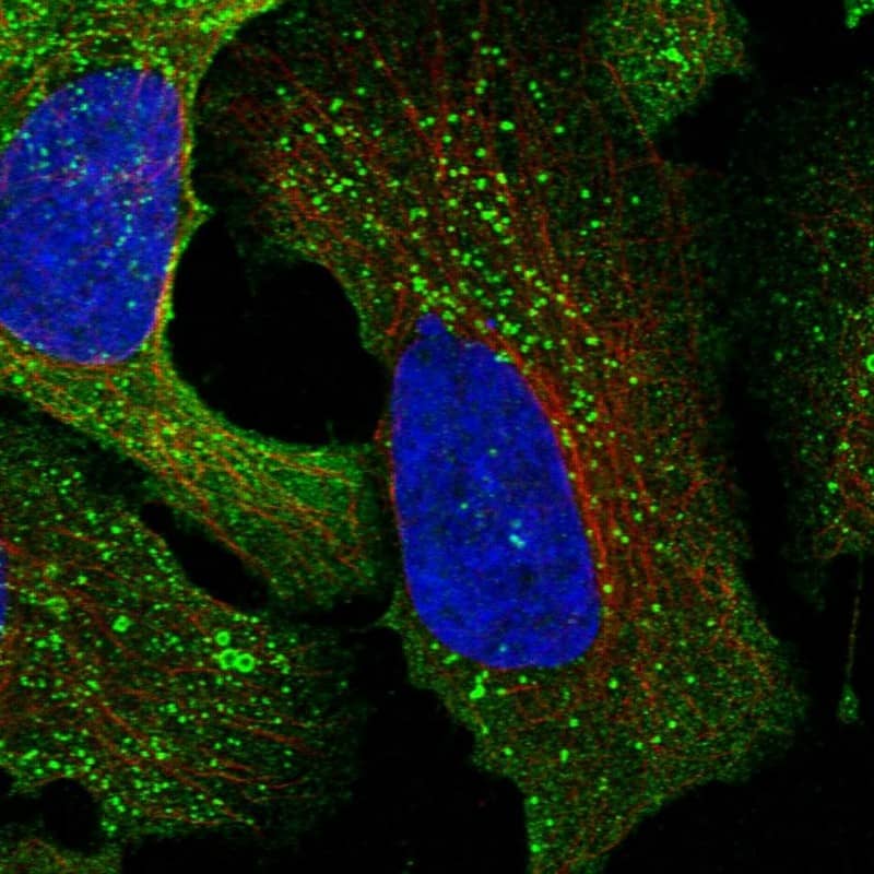 Staining of human cell line U-2 OS shows localization to cytosol & vesicles.