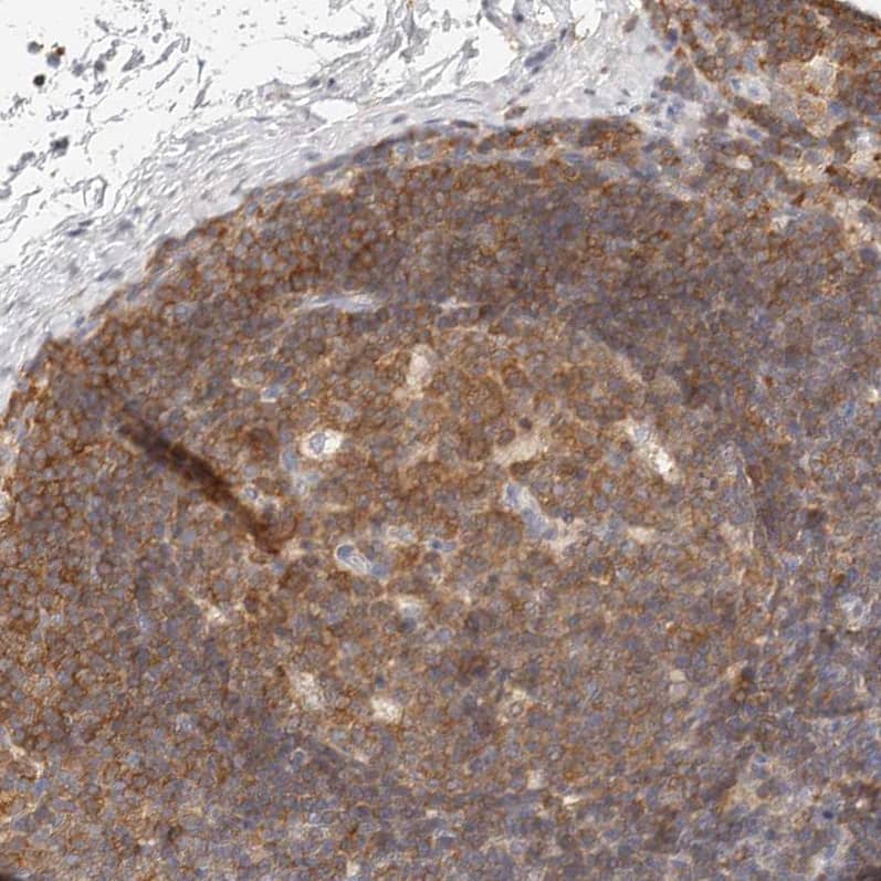 Staining of human lymph node shows weak to moderate cytoplasmic positivity in germinal center cells.