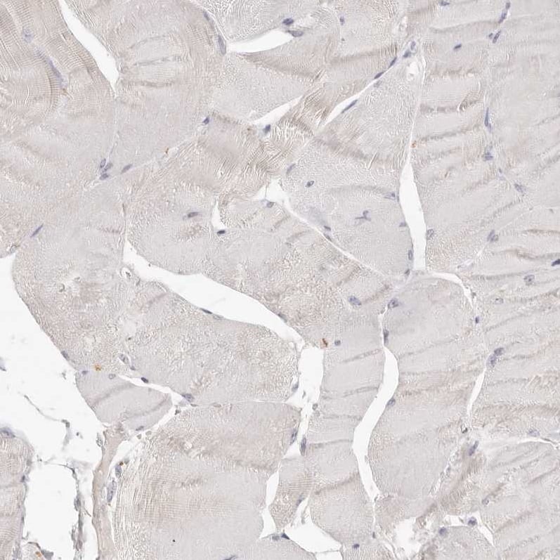 Staining of human skeletal muscle shows no positivity in myocytes as expected.