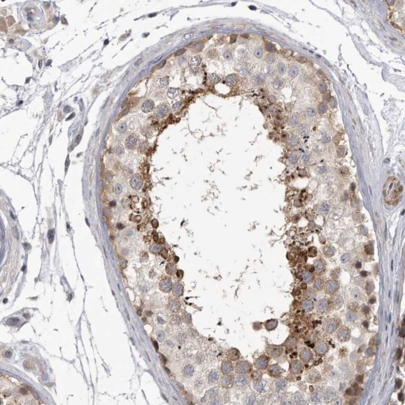 Immunohistochemistry-Paraffin SSX2IP Antibody - BSA Free