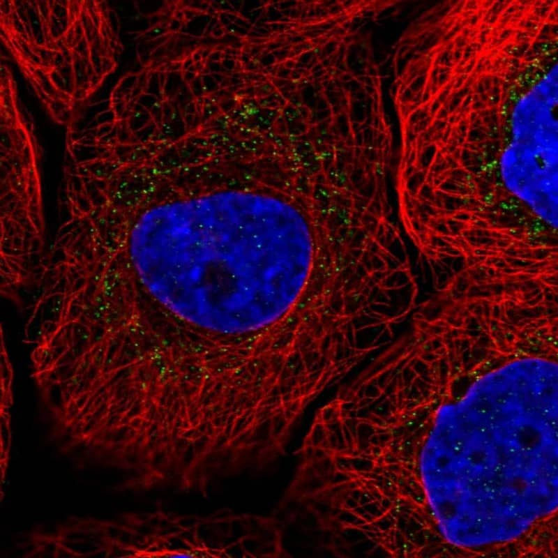 Staining of human cell line A-431 shows localization to vesicles.