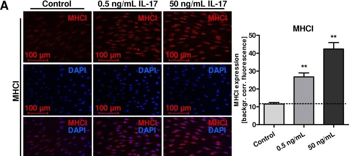 Immunocytochemistry/Immunofluorescence: MHC Class I Antibody (OX18) [NB120-6405] - Major histocompatibility complex (MHC) I and II as well as Transporter associated with antigen presentation II (TAPII) were analyzed, using immunocytochemistry on rat Schwann cells (SCs). Corresponding merges are shown in the bottom rows. Treatment of SCs with IL-17 was performed at concentrations of 0.5 and 50 ng/mL. Graphs to the right show densitometry quantification. SCs showed expression of MHCI > TAPII > MHCII, which increased after IL-17 treatment. MHCI was mainly detected in the cytoplasm and the expression increased in a dose-dependent manner after IL-17 treatment, significant for 0.5 ng/mL and 50 ng/mL (**P  TAPII > MHCII, which increased after IL-17 treatment. (A) MHCI was mainly detected in the cytoplasm and the expression increased in a dose-dependent manner after IL-17 treatment, significant for 0.5 ng/mL and 50 ng/mL (**P ≤0.01). (B) MHCII revealed a fainter basic expression emphasizing the nucleus and was found significantly increased after 0.5 ng/mL IL-17 stimulation (**P ≤ 0.01). (C) TAPII was detected in the nucleus and cytoplasm. We detected a dose-dependent tendency but no significantly increased expression after IL-17 stimulation. For MHCI, TAPII and MHCII and the concentrations applied, analysis of variance between the independent experiments revealed no significant difference. DAPI, 4′, 6-diamidino-2-phenylindole. Image collected and cropped by CiteAb from the following open publication (//pubmed.ncbi.nlm.nih.gov/24678820), licensed under a CC-BY license. Not internally tested by Novus Biologicals.