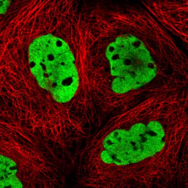 Immunocytochemistry/ Immunofluorescence DNMT3A Antibody - BSA Free