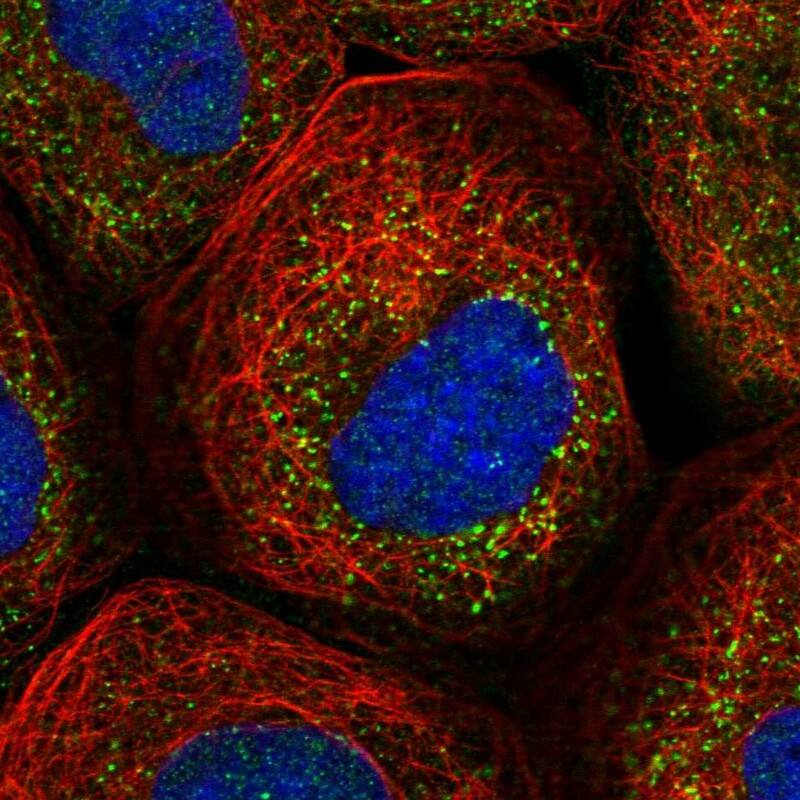 Staining of human cell line A-431 shows localization to vesicles.