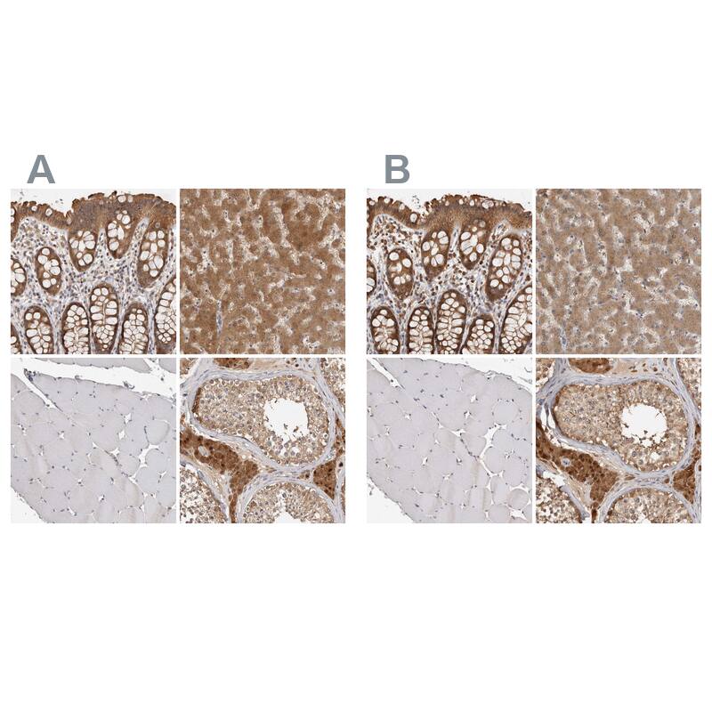 <b>Orthogonal Strategies Validation. </b>Staining of human gastrointestinal, liver, skeletal muscle and testis HPA025811 (A) shows similar protein distribution across tissues to independent antibody HPA025736 (B).