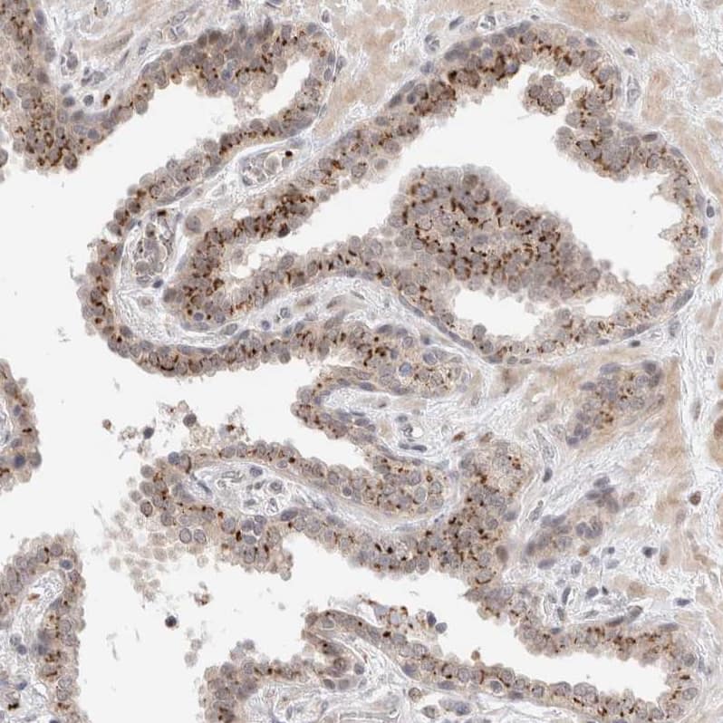Staining of human prostate shows strong cytoplasmic granular positivity in glandular cells.