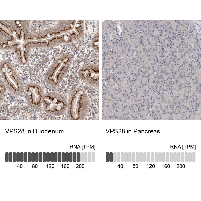 Immunohistochemistry analysis in human duodenum and pancreas tissues using HPA024745 antibody. Corresponding VPS28 RNA-seq data are presented for the same tissues.