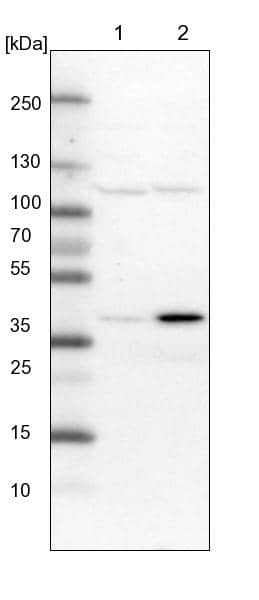 Lane 1: NIH-3T3 cell lysate (Mouse embryonic fibroblast cells)Lane 2: NBT-II cell lysate (Rat Wistar bladder tumour cells)