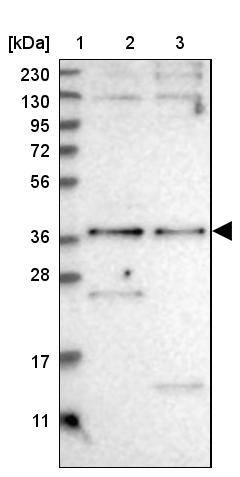 Lane 1: Marker [kDa] 230, 130, 95, 72, 56, 36, 28, 17, 11Lane 2: Human cell line RT-4Lane 3: Human cell line U-251MG sp