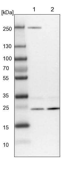 Lane 1: NIH-3T3 cell lysate (Mouse embryonic fibroblast cells)Lane 2: NBT-II cell lysate (Rat Wistar bladder tumour cells)