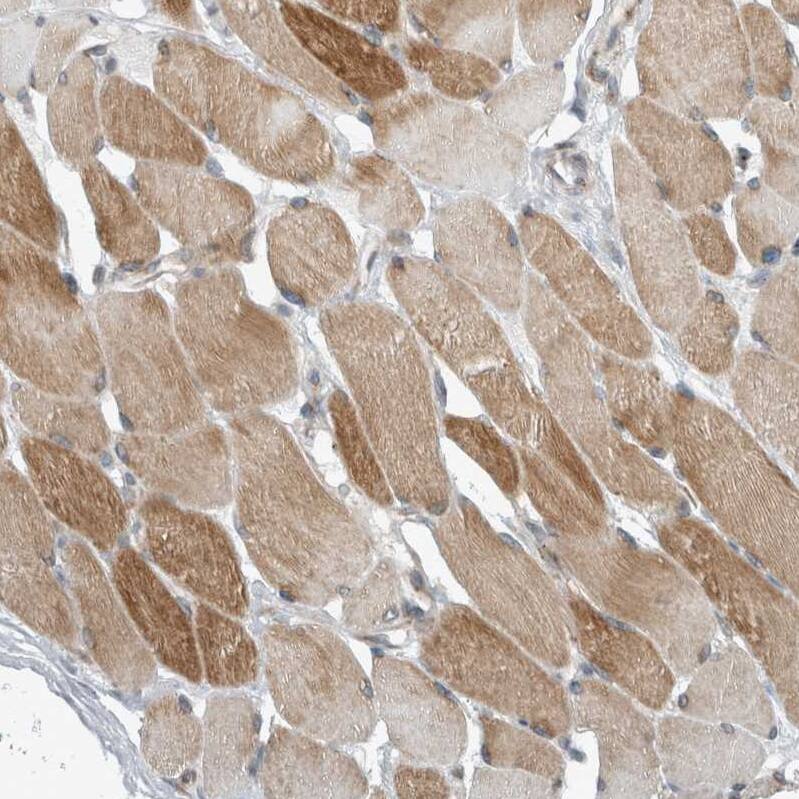 Immunohistochemistry-Paraffin KIF1C Antibody - BSA Free