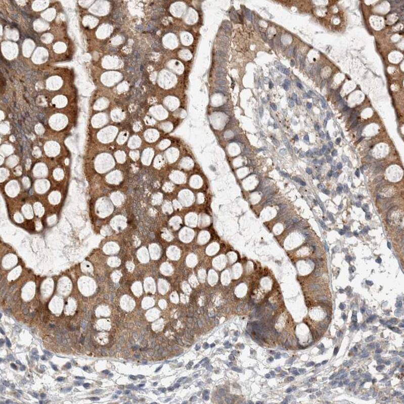 Immunohistochemistry-Paraffin KIF1C Antibody - BSA Free