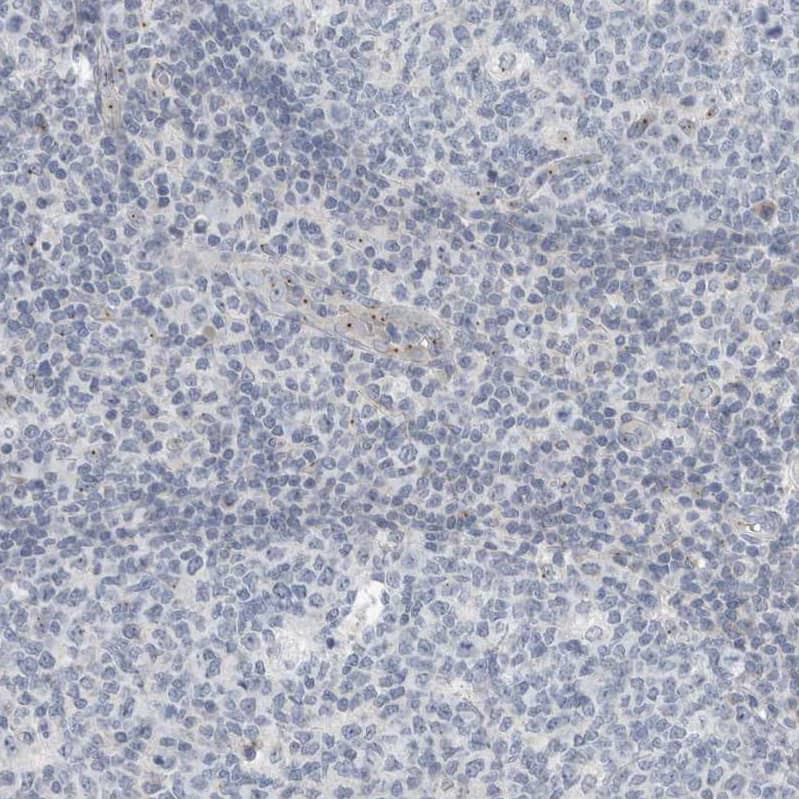Staining of human tonsil shows low positivity in non-germinal center cells as expected.