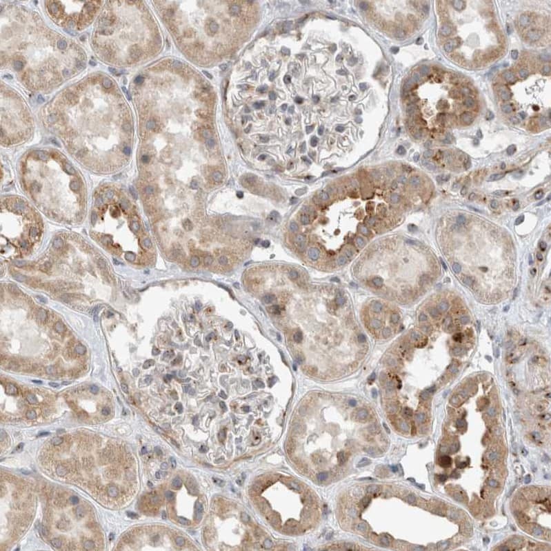 Staining of human kidney shows weak to moderate cytoplasmic positivity in cells in tubules.