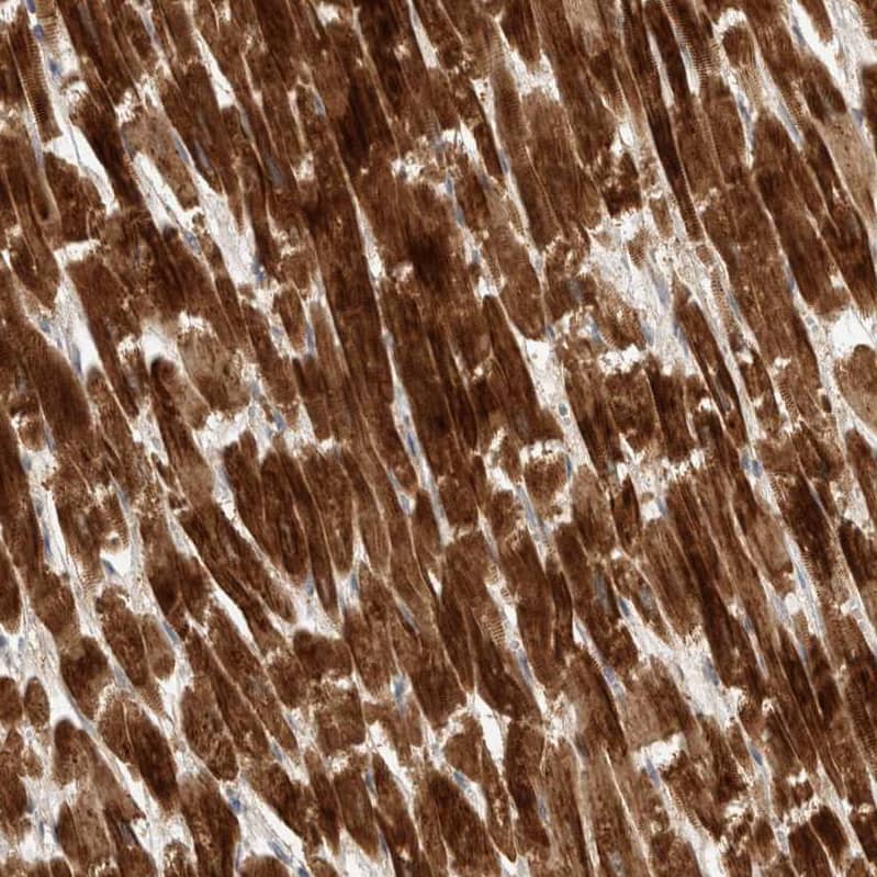 Staining of human heart muscle shows strong cytoplasmic positivity in cardiomyocytes.