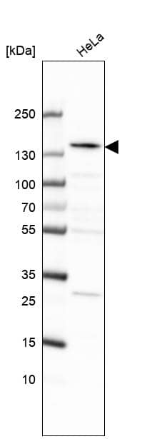 Analysis in human cell line HeLa.
