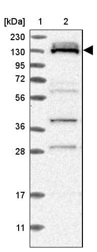 Lane 1: Marker [kDa] 230, 130, 95, 72, 56, 36, 28, 17, 11Lane 2: Human cell line RT-4