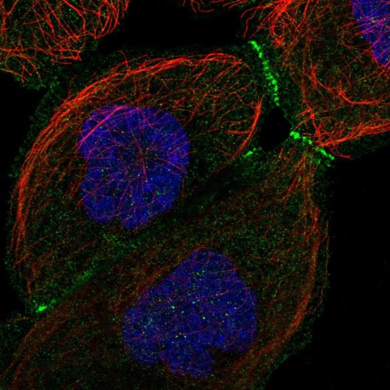 Staining of human cell line A-431 shows localization to plasma membrane & cell junctions.