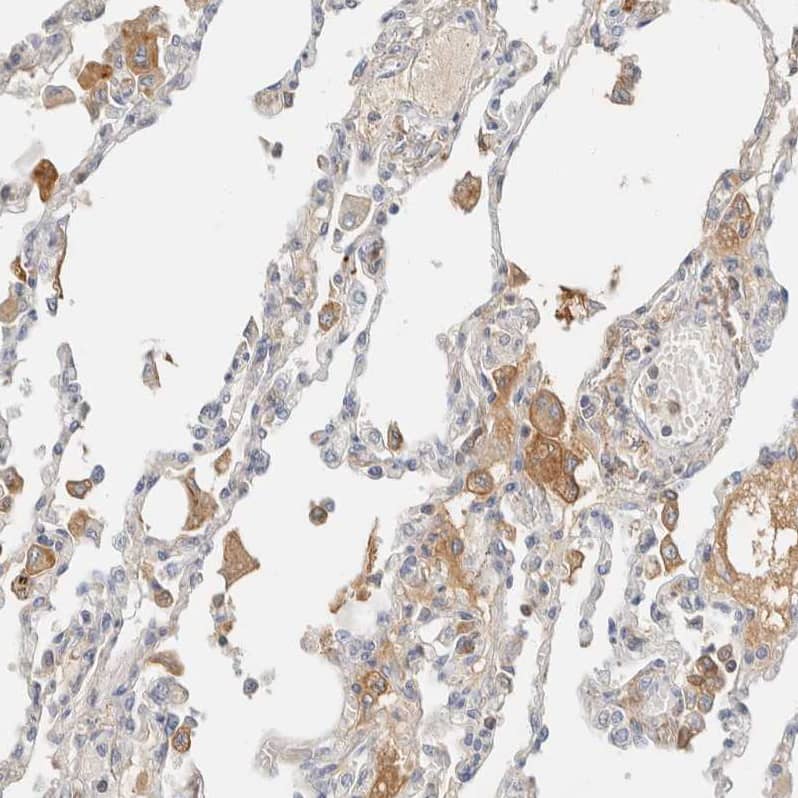 Staining of human lung shows weak to moderate cytoplasmic positivity in macrophages.