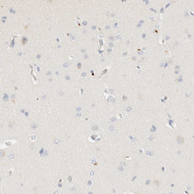 Staining of human cerebral cortex shows no positivity in neurons.