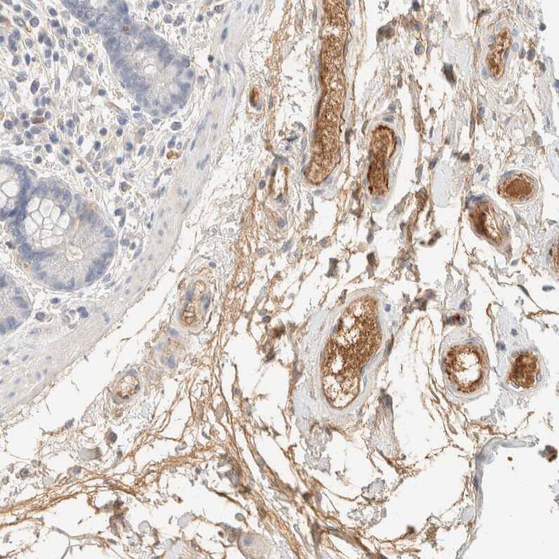 Staining of human colon shows weak to moderate positivity in plasma in endothelial cells.
