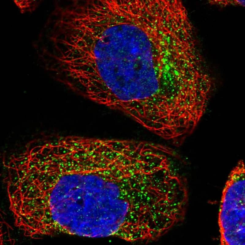 Staining of human cell line A-431 shows localization to vesicles.