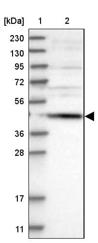 Lane 1: Marker [kDa] 230, 130, 95, 72, 56, 36, 28, 17, 11Lane 2: Human cell line RT-4