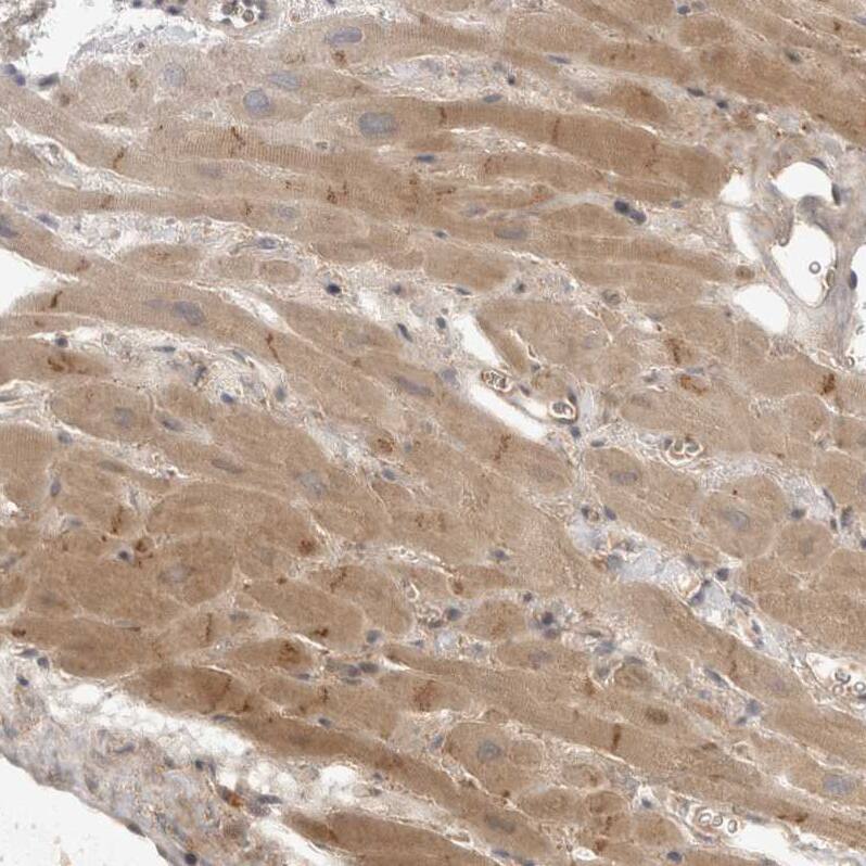 Staining of human heart muscle shows moderate granular cytoplasmic positivity in cardiomyocytes.