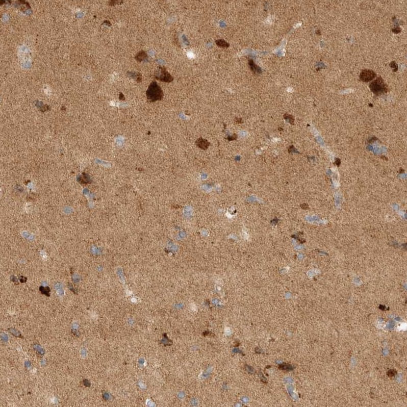 Immunohistochemistry-Paraffin TOM1L2 Antibody - BSA Free