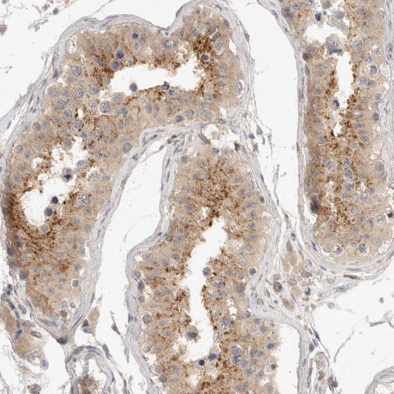 Immunohistochemistry-Paraffin TOM1L2 Antibody - BSA Free