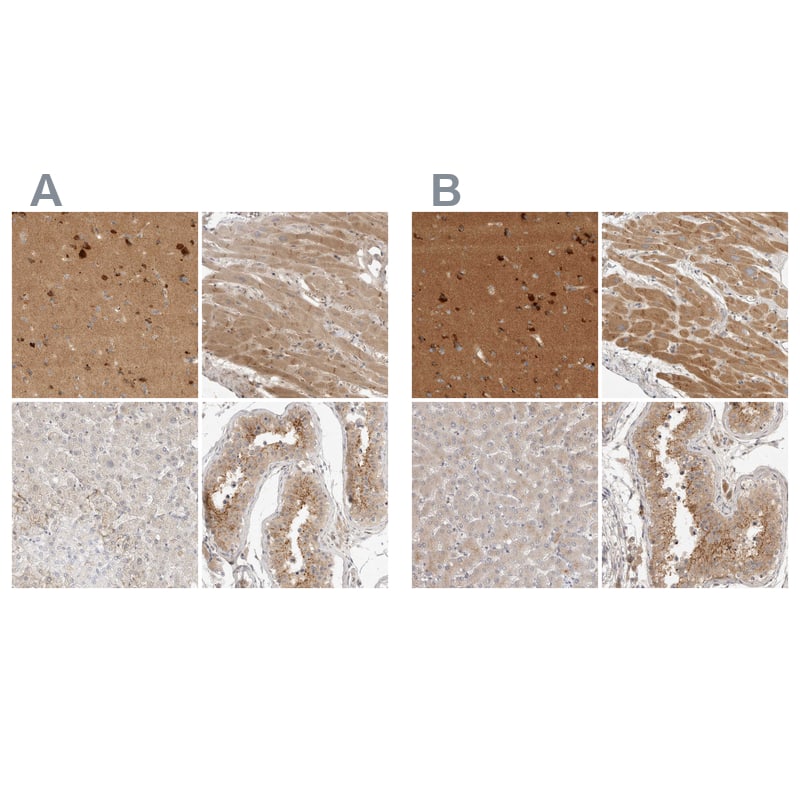 Staining of human cerebral cortex, heart muscle, liver and testis using Anti-TOM1L2 antibody NBP1-86006 (A) shows similar protein distribution across tissues to independent antibody NBP1-86414 (B).