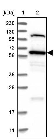 Lane 1: Marker [kDa] 230, 130, 95, 72, 56, 36, 28, 17, 11Lane 2: Human cell line RT-4