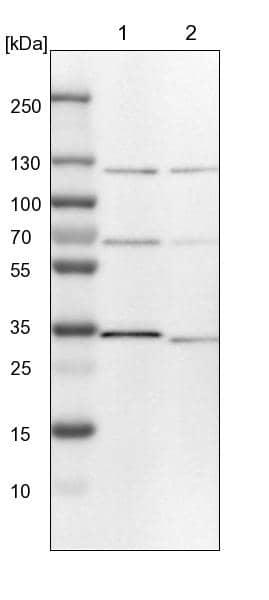 Lane 1: NIH-3T3 cell lysate (Mouse embryonic fibroblast cells)Lane 2: NBT-II cell lysate (Rat Wistar bladder tumour cells)