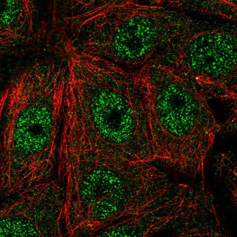 Staining of human cell line MCF7 shows localization to nucleoplasm.