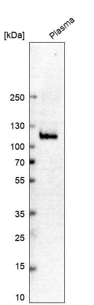Analysis in human plasma.