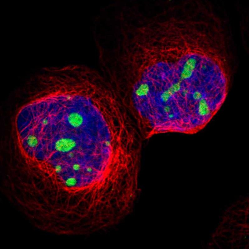 Staining of human cell line A-431 shows localization to nucleoli.