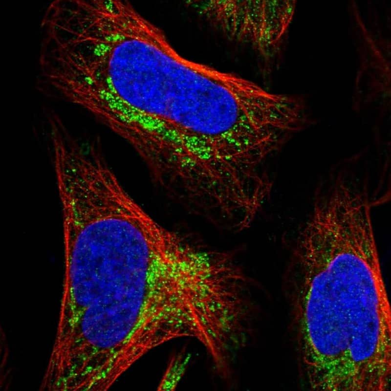 Immunocytochemistry/ Immunofluorescence MALSU1 Antibody - BSA Free