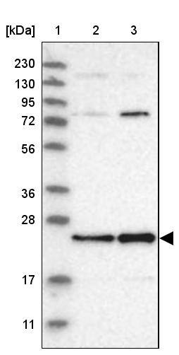 Lane 1: Marker [kDa] 230, 130, 95, 72, 56, 36, 28, 17, 11Lane 2: Human cell line RT-4Lane 3: Human cell line U-251MG sp