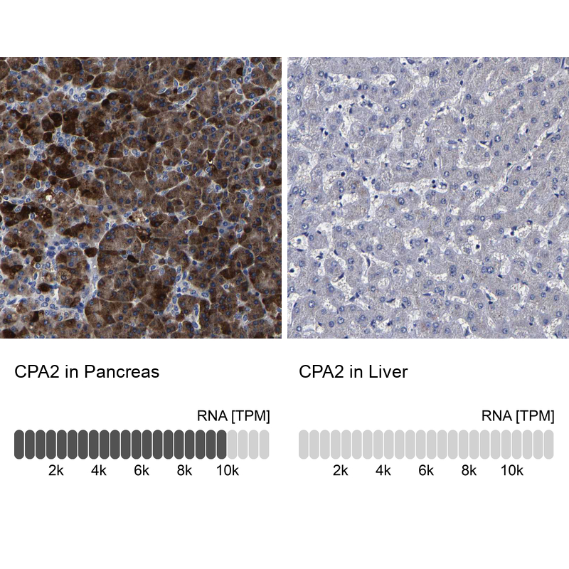 Immunohistochemistry-Paraffin Carboxypeptidase A2/CPA2 Antibody - BSA Free