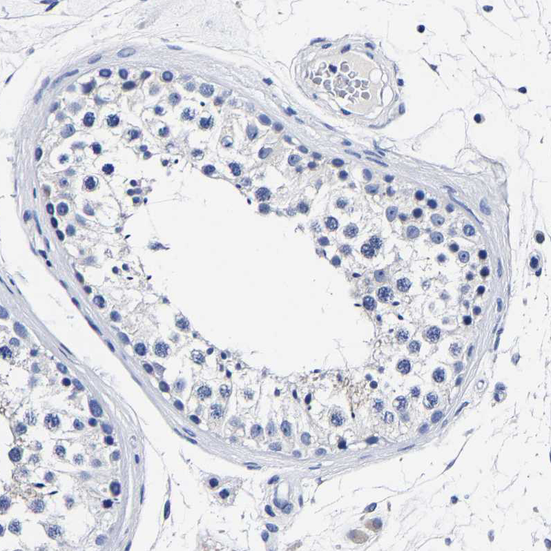 Immunohistochemistry-Paraffin Carboxypeptidase A2/CPA2 Antibody - BSA Free