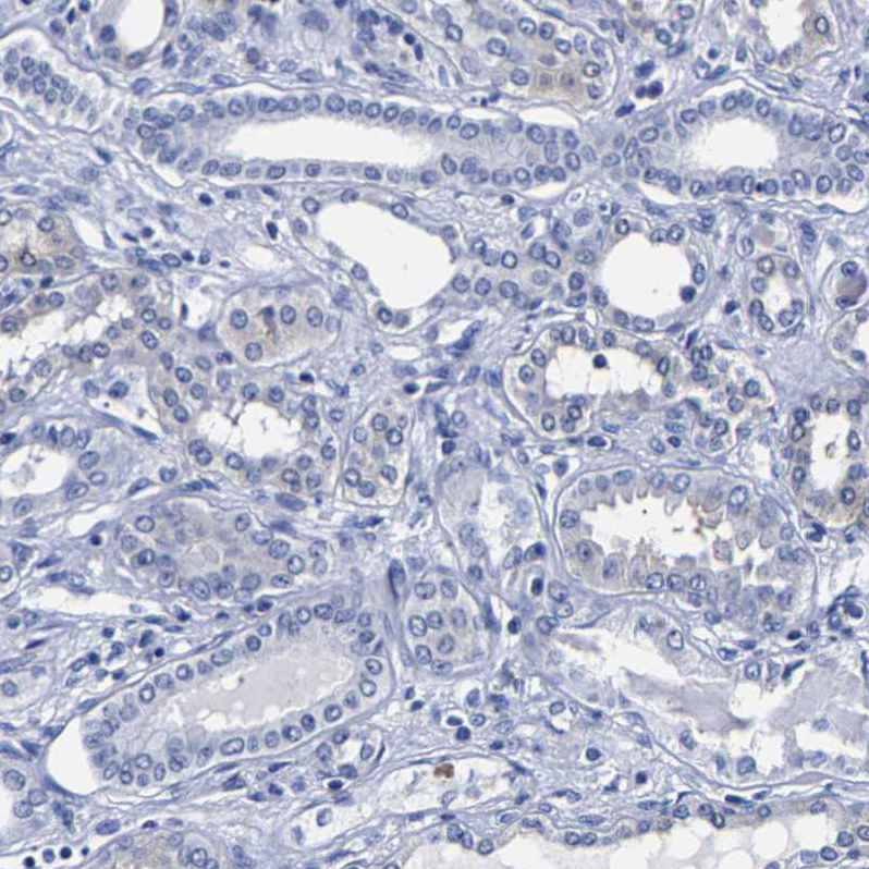 Immunohistochemistry-Paraffin Carboxypeptidase A2/CPA2 Antibody - BSA Free