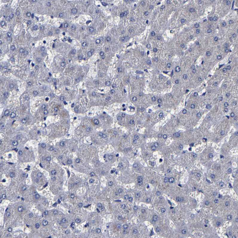 Immunohistochemistry-Paraffin Carboxypeptidase A2/CPA2 Antibody - BSA Free