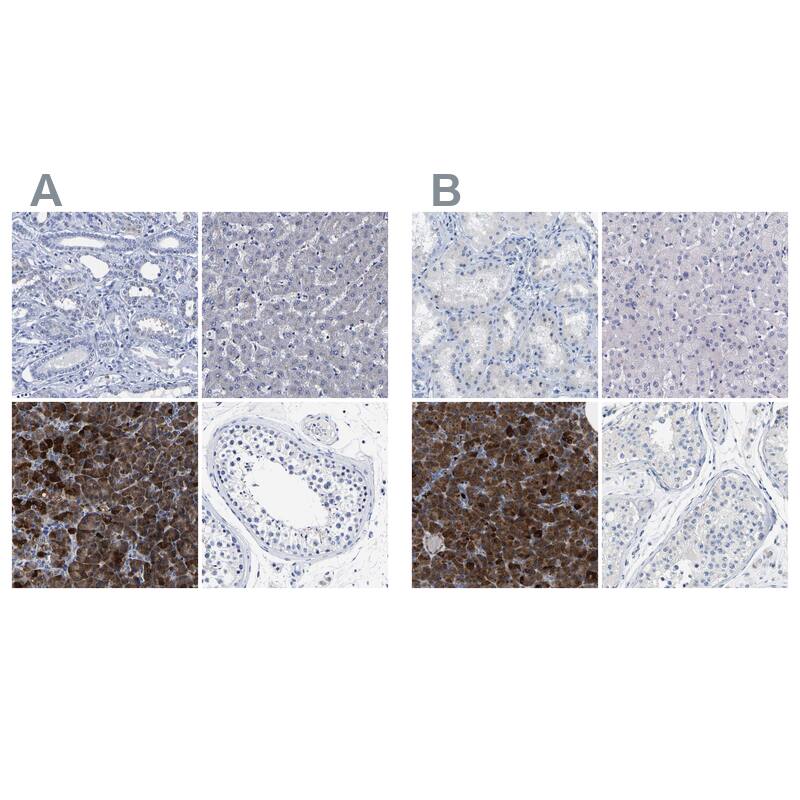 Immunohistochemistry-Paraffin Carboxypeptidase A2/CPA2 Antibody - BSA Free