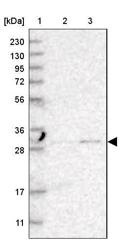 Lane 1: Marker [kDa] 230, 130, 95, 72, 56, 36, 28, 17, 11Lane 2: Human cell line RT-4Lane 3: Human cell line U-251MG sp