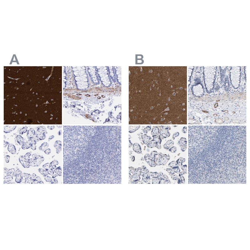 <b>Orthogonal Strategies Validation. </b>Staining of human cerebral cortex, colon, placenta and tonsil HPA019829 (A) shows similar protein distribution across tissues to independent antibody HPA019828 (B).