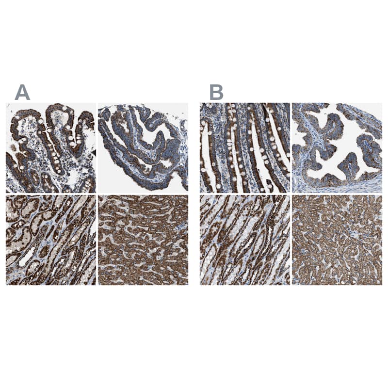 <b>Independent Antibodies Validation. </b>Staining of human duodenum, fallopian tube, kidney and liver using Anti-MDH2 antibody NBP1-86036 (A) shows similar protein distribution across tissues to independent antibody NBP1-89540 (B).