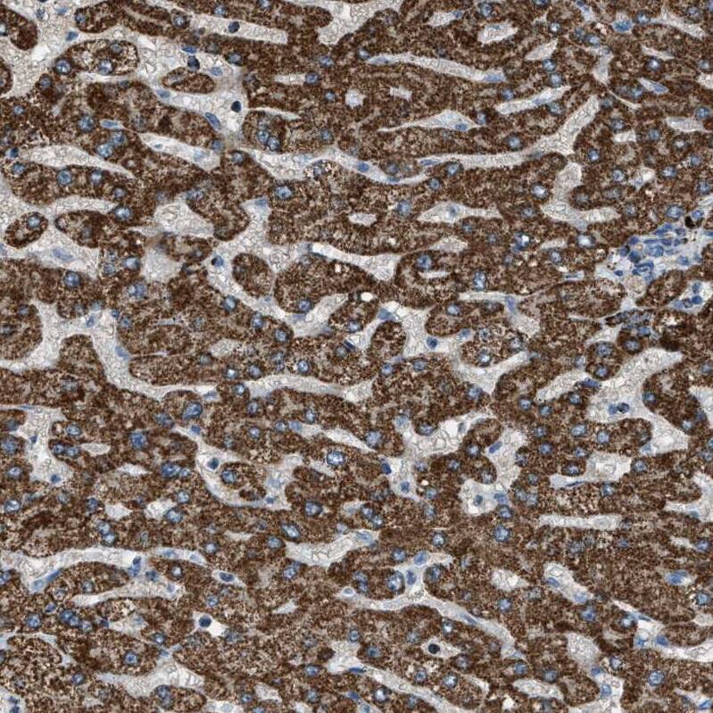 Staining of human liver shows strong positivity in cytoplasm granular in hepatocytes.