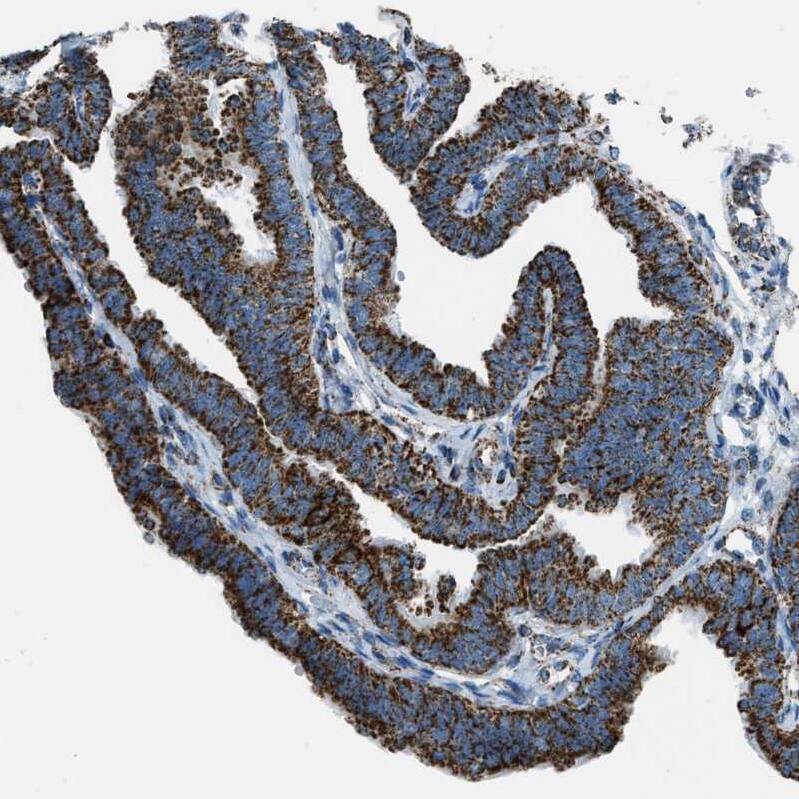 Staining of human fallopian tube shows strong positivity in cytoplasm granular in cells in tubules.