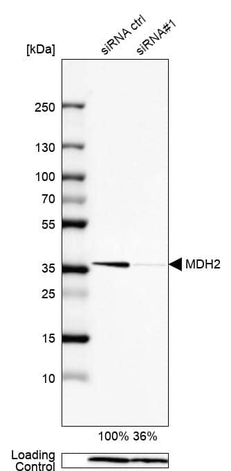 <b>Genetic Strategies Validation. </b>Analysis in HEK293 cells transfected with control siRNA, target specific siRNA probe #1, using Anti-MDH2 antibody. Remaining relative intensity is presented. Loading control: Anti-PPIB.