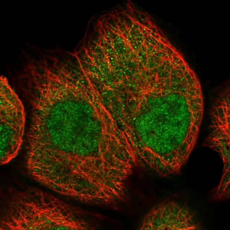 Staining of human cell line A-431 shows localization to nucleoplasm & cytosol.